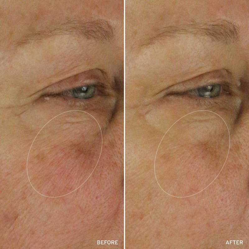 NAD+ CELL ENERGIZING TREATMENT - themonogram manor 