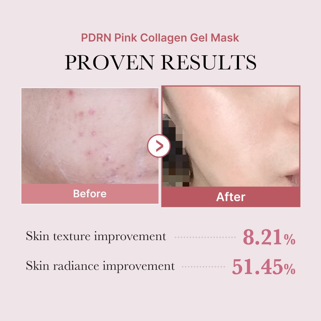Salmon PDRN Pink Collagen Jelly Gel Mask - themonogram manor 