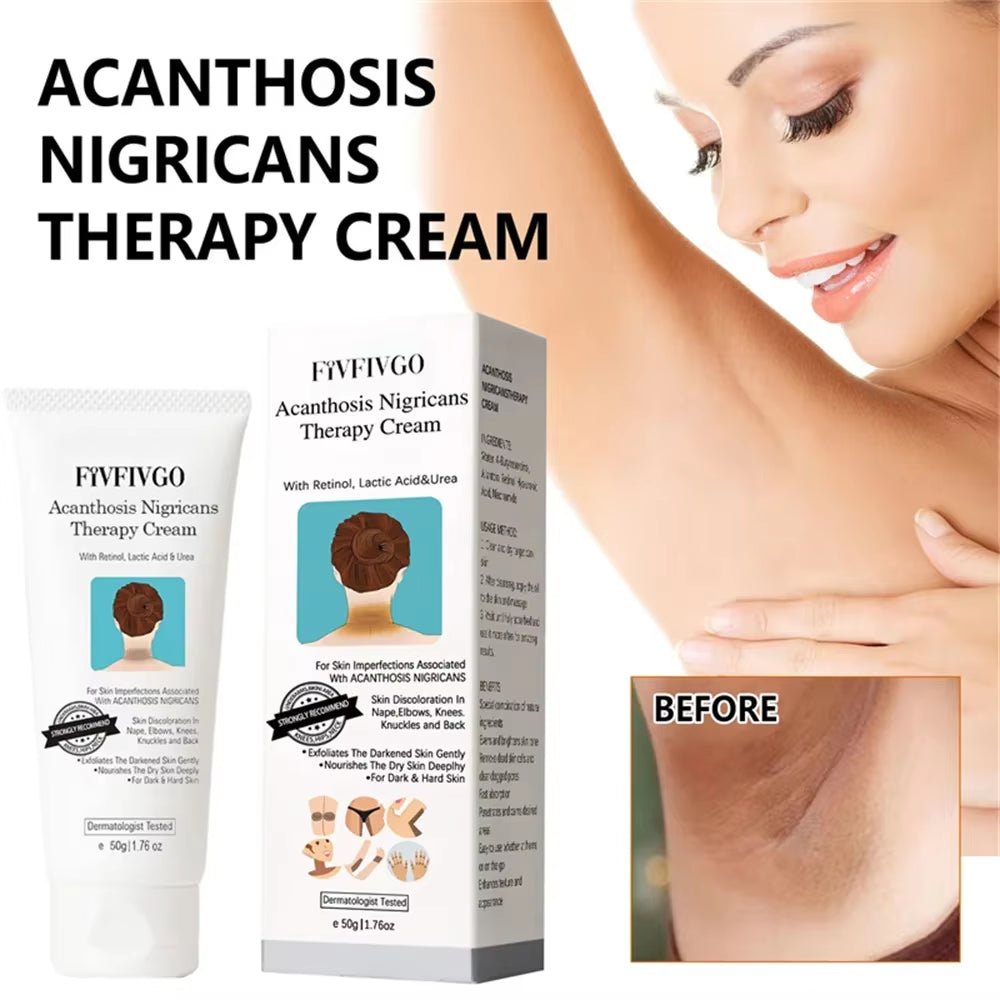 Underarm Creams for Dark Skin Body Crotch Armpit Moisturizing Korean Skincare Products 50G - themonogram manor 
