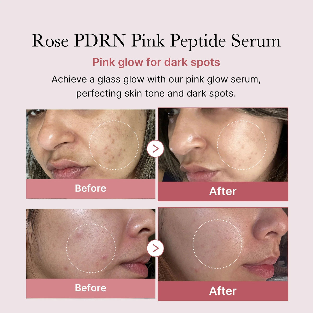 PDRN Pink Peptide Serum - themonogram manor 