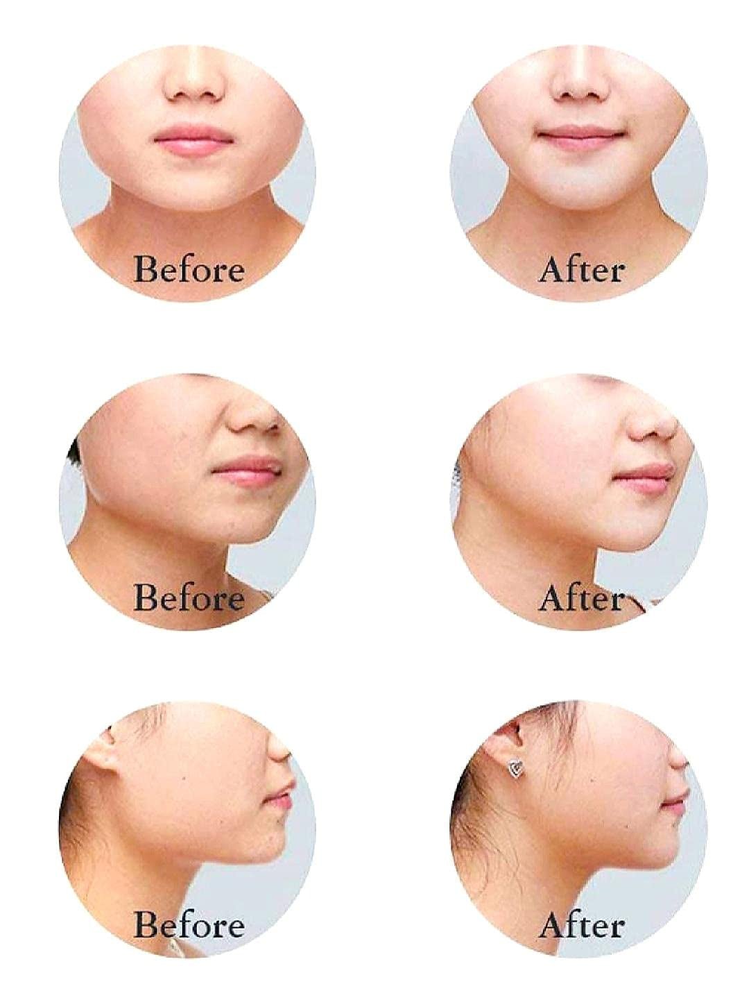SLIM FACE SLIMMING BAND FACIAL BELT DOUBLE CHIN REDUCER V LINE FACE LIFT anti SNORE WRINKLE FACE BANDAGE DOUBLE CHIN STRAP SAGGING FACE CONTOUR JAWLINE TIGHTEN STRAP 1PK - themonogram manor 
