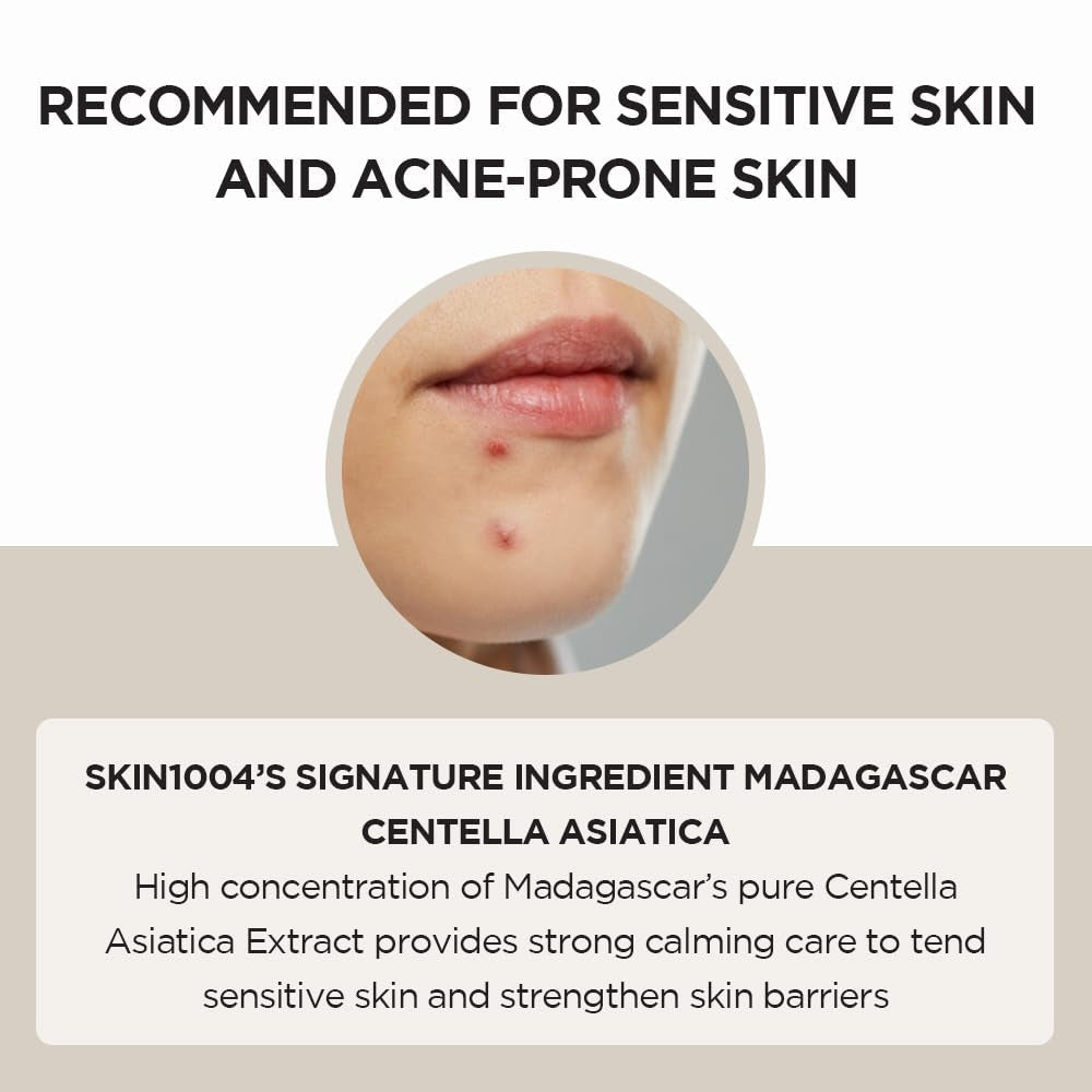 Madagascar Centella Asiatica Ampoule Facial Serum 1.85 Fl.Oz, 55Ml, Soothes Acne Prone and Sensitive Skin - themonogram manor 