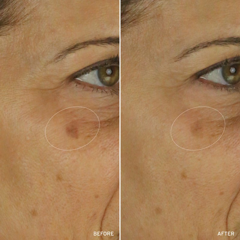 NAD+ CELL ENERGIZING TREATMENT - themonogram manor 