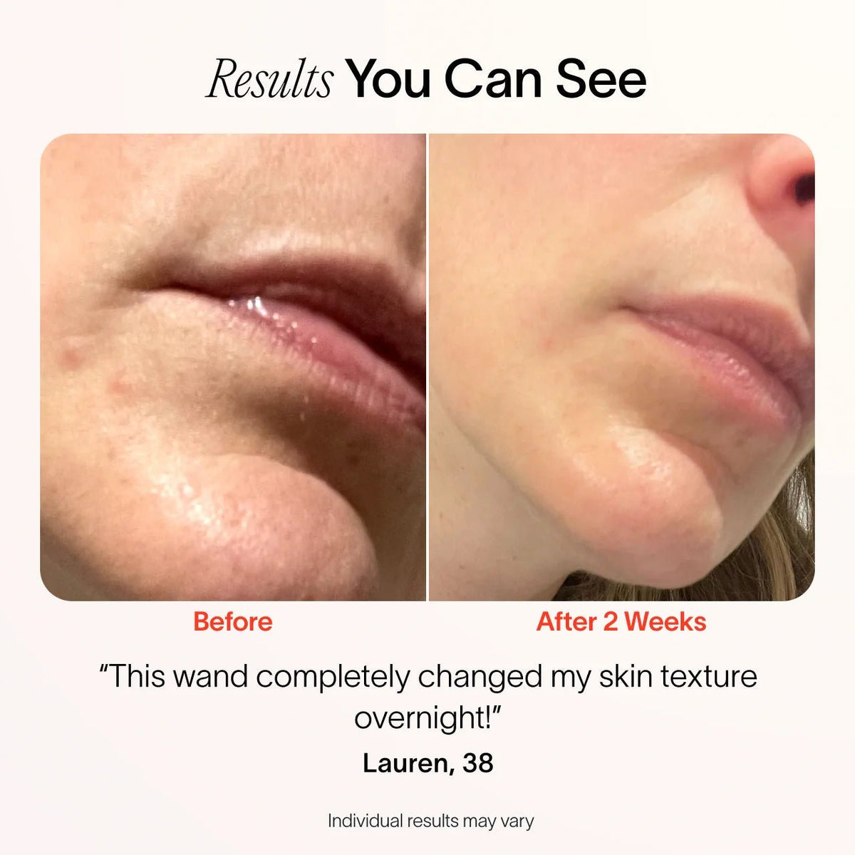 4-In-1 Radiant Renewal Skincare Wand with Red Light Therapy - themonogram manor 