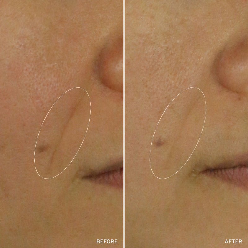 NAD+ CELL ENERGIZING TREATMENT - themonogram manor 