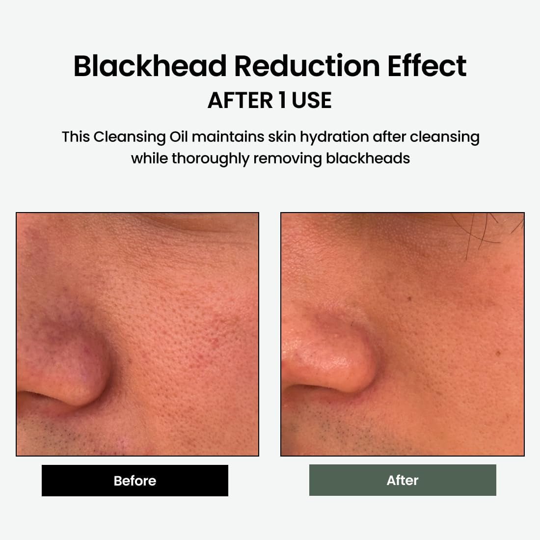 Liposome Daily Cleansing Oil, Gentle Makeup & Blackhead Remover for Sensitive Skin with Centella Asiatica TECA, Korean Skincare for Trouble Care (6.76 Fl. Oz., 200Ml) - themonogram manor 