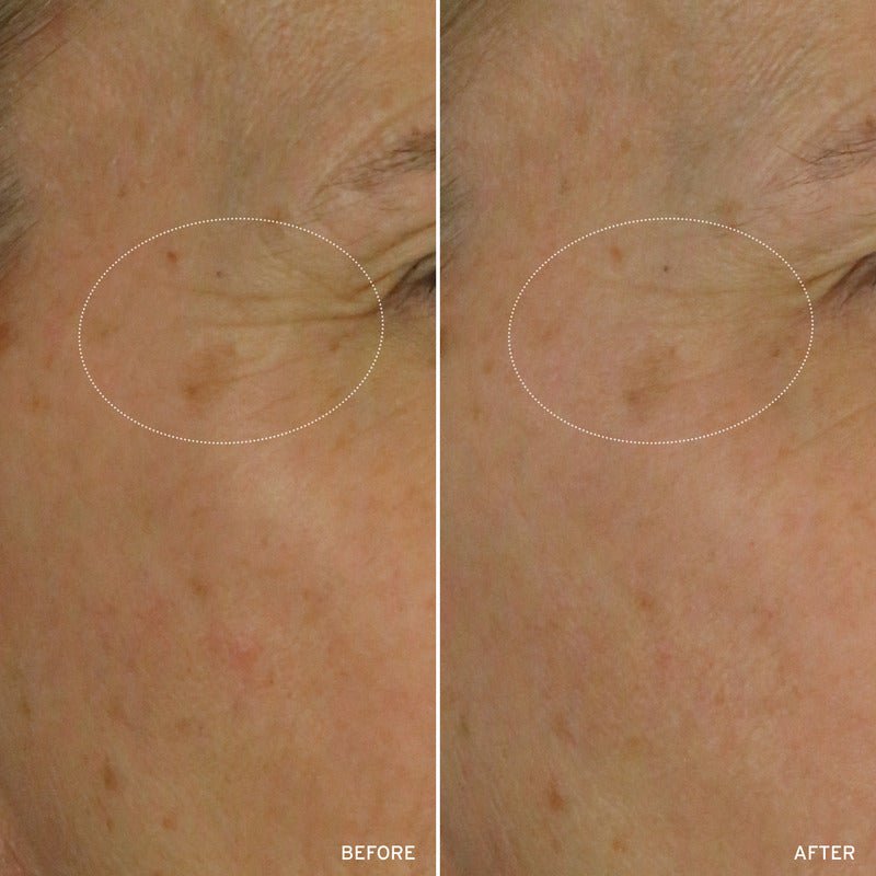 NAD+ CELL ENERGIZING TREATMENT - themonogram manor 