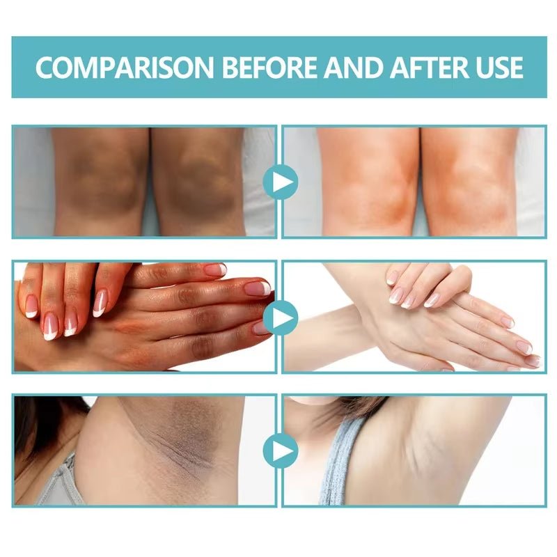 Underarm Creams for Dark Skin Body Crotch Armpit Moisturizing Korean Skincare Products 50G - themonogram manor 