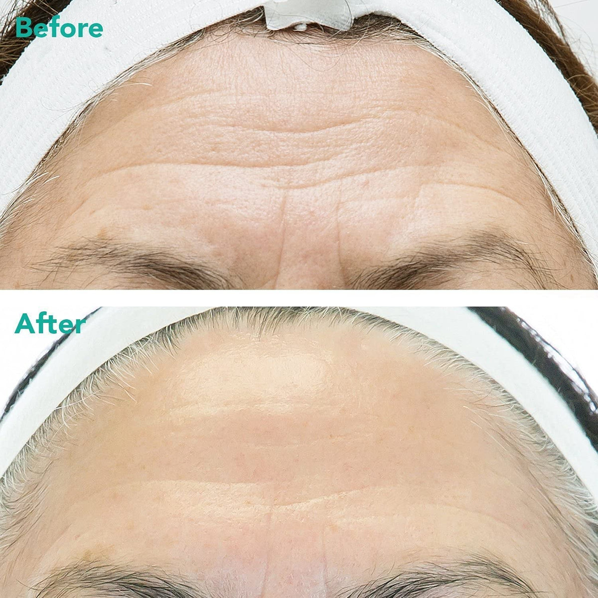 ® Advanced Anti-Aging Retinol + C-Pdrn® Serum - Boosting Facial Serum for Firmness, Radiance and Anti-Wrinkle Care, Clinically Developed (1.01 Fl Oz) - themonogram manor 